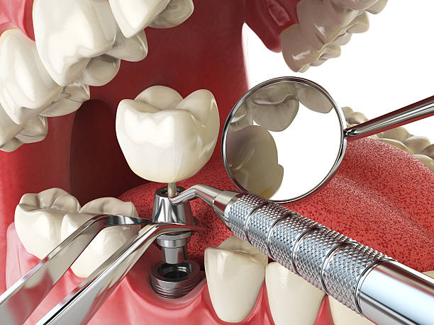 Best Emergency Dental Clinic in IL